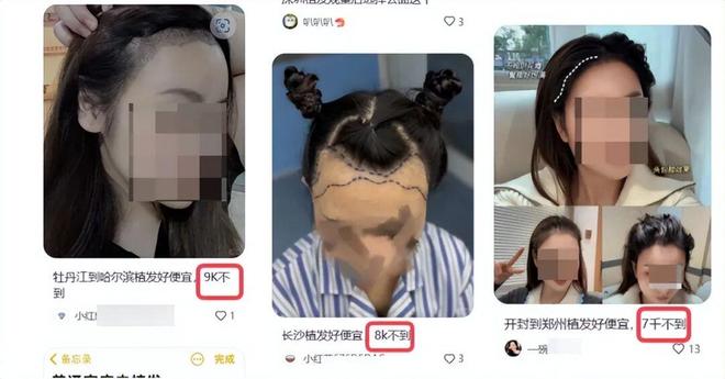 PG平台暴涨超400%！62岁老人收割头发一年狂揽14亿闷声发大财！(图24)