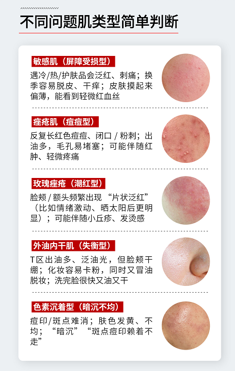 北京煤医美容皮肤科李雪萍主任：问题肌修复抗衰~量肤定制——还肌肤净亮无瑕(图2)