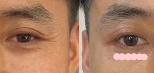 PG电子网站男士护肤品抗皱抗衰老40岁男士抗皱护肤品：水乳就选它(图4)