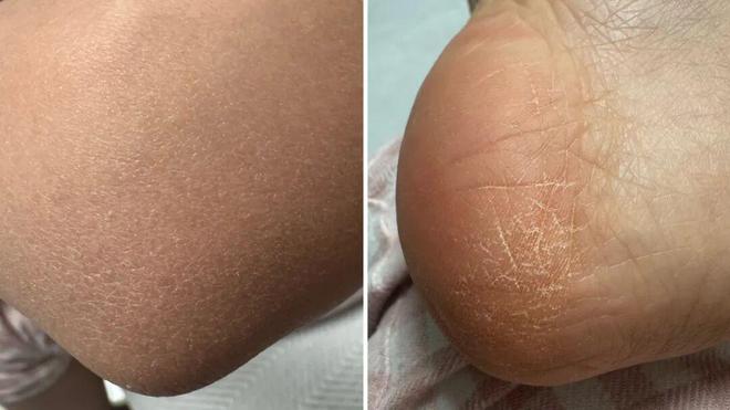 PG平台你真的分得清皮肤是干、是敏还是痒吗？(图3)