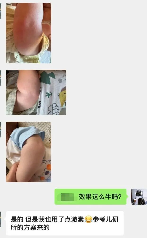 PG平台你真的分得清皮肤是干、是敏还是痒吗？(图2)