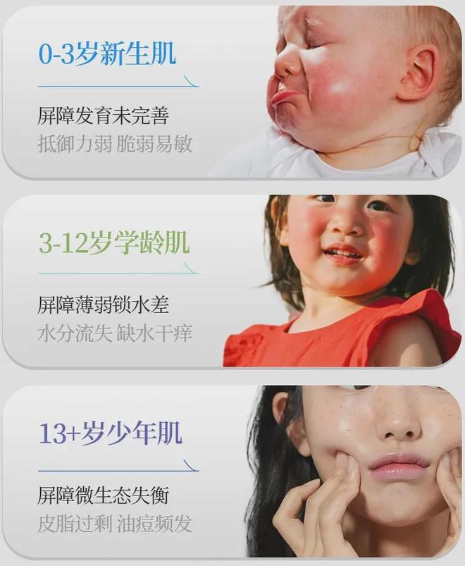 PG平台你真的分得清皮肤是干、是敏还是痒吗？(图16)